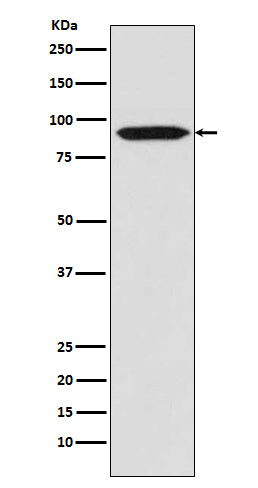 Bcl-6 (3J5) Rabbit Monoclonal Antibody