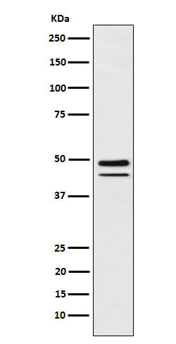 Brachyury (4T11) Rabbit Monoclonal Antibody