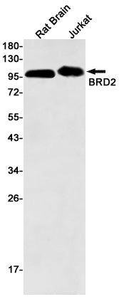 BRD2 (1I19) Rabbit Monoclonal Antibody