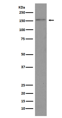 Brd4 (2D15) Rabbit Monoclonal Antibody