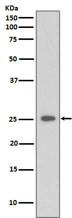C Reactive Protein (15D4) Rabbit Monoclonal Antibody