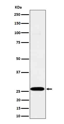 C1QA (17R4) Rabbit Monoclonal Antibody