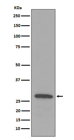 C1QB (12D10) Rabbit Monoclonal Antibody
