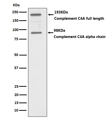 C4A (15Q18) Rabbit Monoclonal Antibody