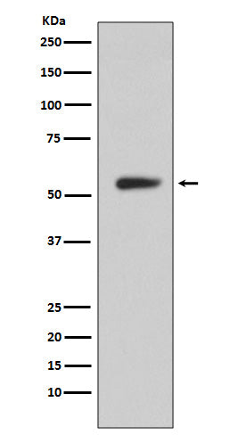 CA9 (14N17) Rabbit Monoclonal Antibody