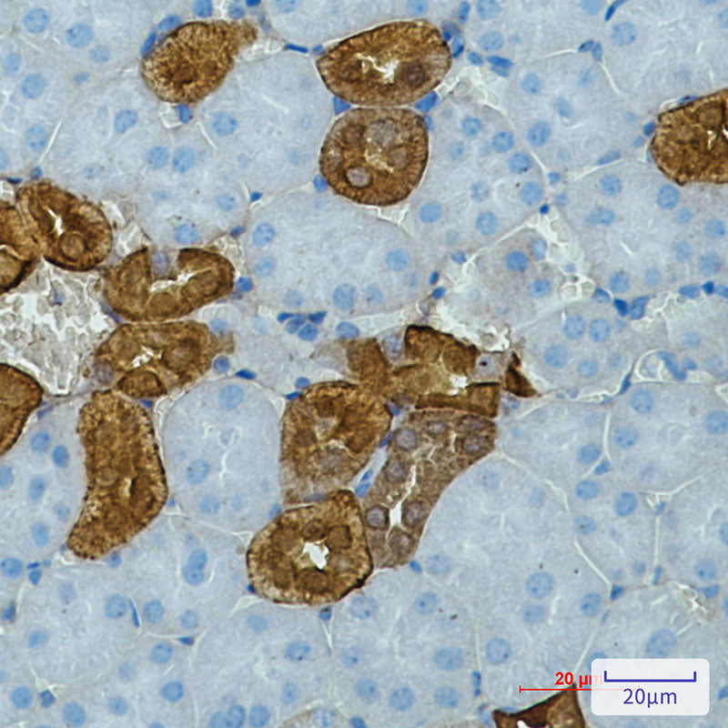 Calbindin (12D5) Rabbit Monoclonal Antibody