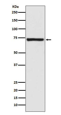 Calpain 1 (19K17) Rabbit Monoclonal Antibody