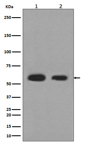Calreticulin (3B4) Rabbit Monoclonal Antibody