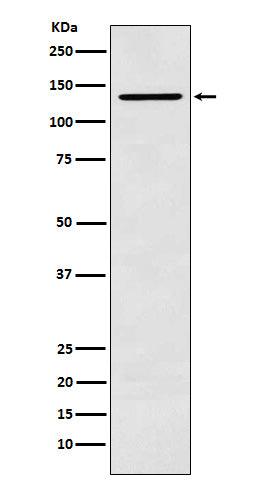 CARD11 (6T8) Rabbit Monoclonal Antibody
