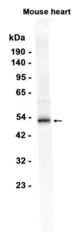 Caspase 9 (3P11) Rabbit Monoclonal Antibody