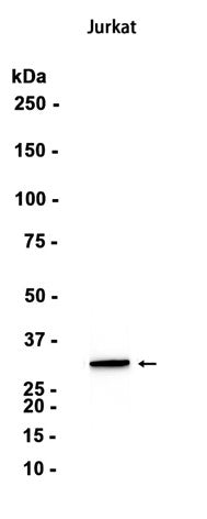 Caspase-6 (13P13) Rabbit Monoclonal Antibody