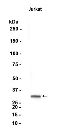Caspase-6 (7O3) Rabbit Monoclonal Antibody