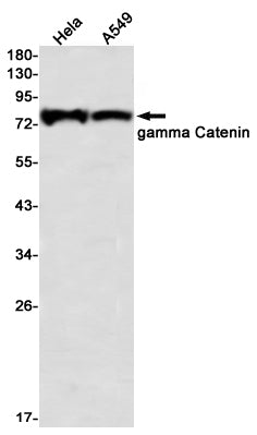 Catenin gamma (14M19) Rabbit Monoclonal Antibody