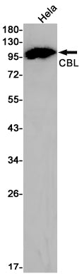 CBL (5W16) Rabbit Monoclonal Antibody