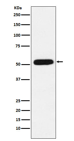 CBX4 (10P4) Rabbit Monoclonal Antibody