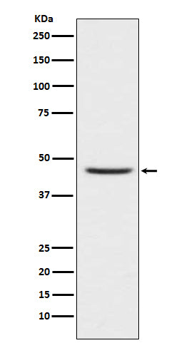 CCR8 (11B19) Rabbit Monoclonal Antibody