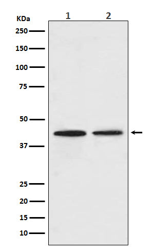 CCR9 (11E6) Rabbit Monoclonal Antibody