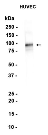 CD105 (15P10) Rabbit Monoclonal Antibody