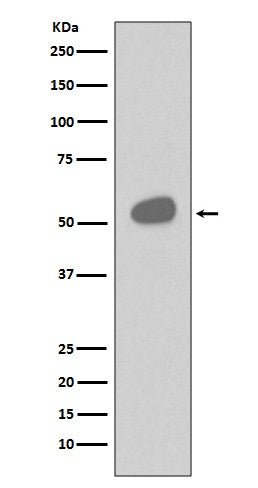 CD14 (16H16) Rabbit Monoclonal Antibody