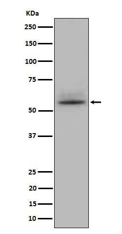 CD147 (8C17) Rabbit Monoclonal Antibody