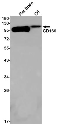 CD166 (7L2) Rabbit Monoclonal Antibody