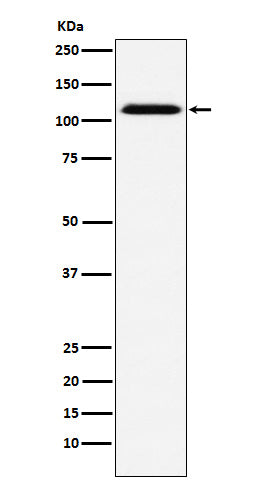 CD30 (15R5) Rabbit Monoclonal Antibody