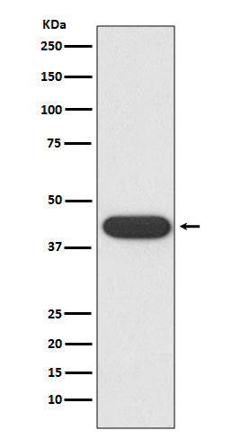 CD32 (12Q18) Rabbit Monoclonal Antibody