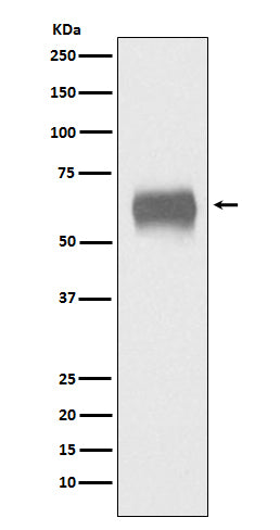 CD5 (11H13) Rabbit Monoclonal Antibody