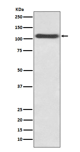CD62P (16H10) Rabbit Monoclonal Antibody