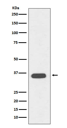 CD68 (6P4) Rabbit Monoclonal Antibody
