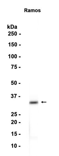 CD79B (7S17) Rabbit Monoclonal Antibody
