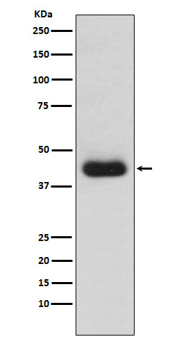CD82 (8T8) Rabbit Monoclonal Antibody