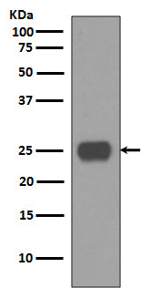CD90 / Thy1 (2D12) Rabbit Monoclonal Antibody