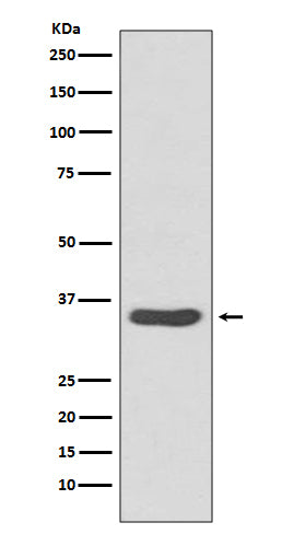 CDCA5 (6T5) Rabbit Monoclonal Antibody