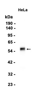 CDK8 (2S1) Rabbit Monoclonal Antibody
