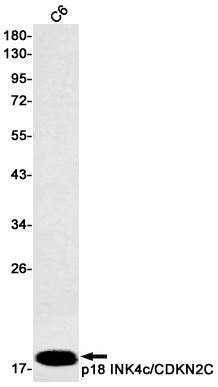 CDKN2C (10M18) Rabbit Monoclonal Antibody
