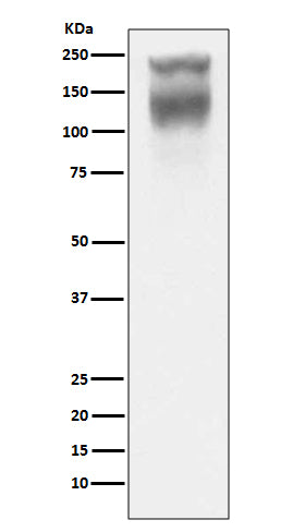 CEA(CD66e) (7M6) Rabbit Monoclonal Antibody