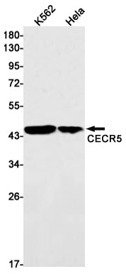 CECR5 (17M19) Rabbit Monoclonal Antibody