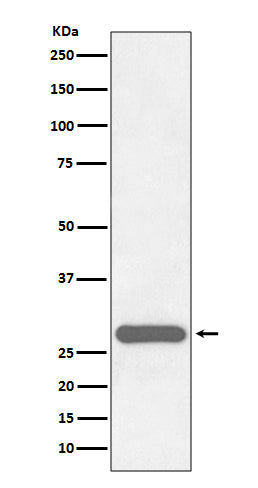 CITED2 (17H2) Rabbit Monoclonal Antibody