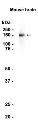 c-Kit (8Y9) Rabbit Monoclonal Antibody