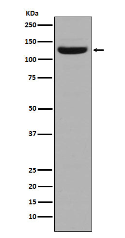 Collagen I (7F14) Rabbit Monoclonal Antibody