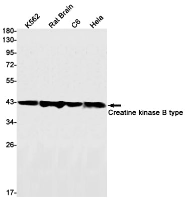 Creatine kinase B type (12W4) Rabbit Monoclonal Antibody