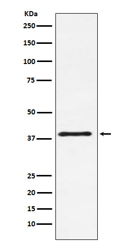 CTLA4 (CD152) (14H2) Rabbit Monoclonal Antibody