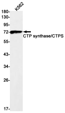 CTP synthase / CTPS (13B6) Rabbit Monoclonal Antibody