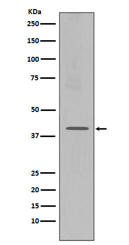 CXCR4 (8E12) Rabbit Monoclonal Antibody