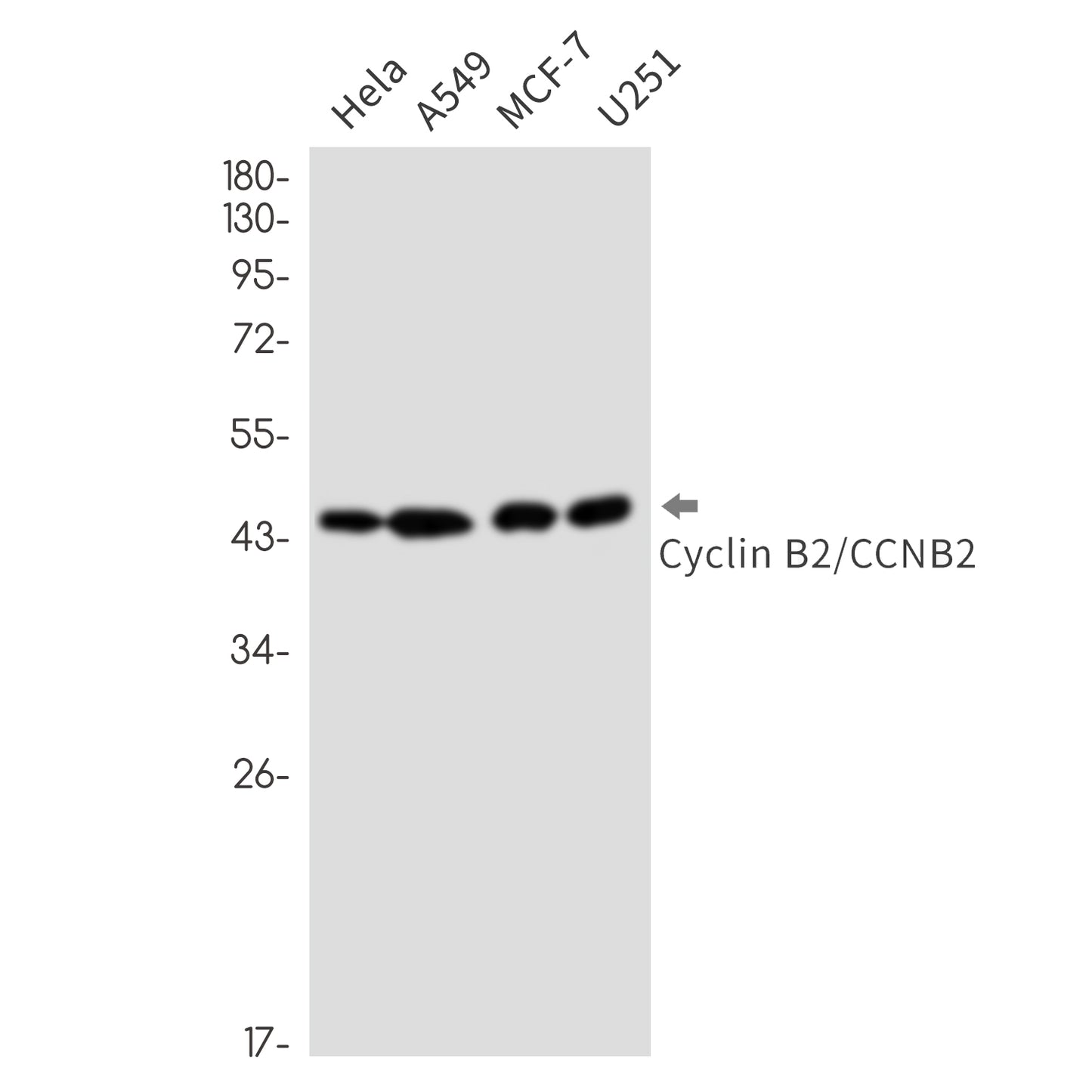 Cyclin B2 (18U13) Rabbit Monoclonal Antibody