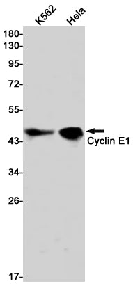 Cyclin E1 (19C1) Rabbit Monoclonal Antibody
