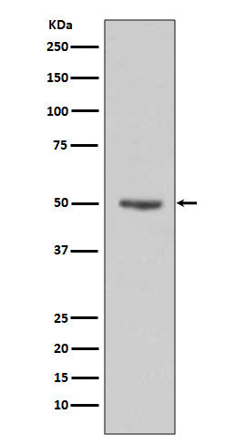 Cyclin E1 (4X19) Rabbit Monoclonal Antibody