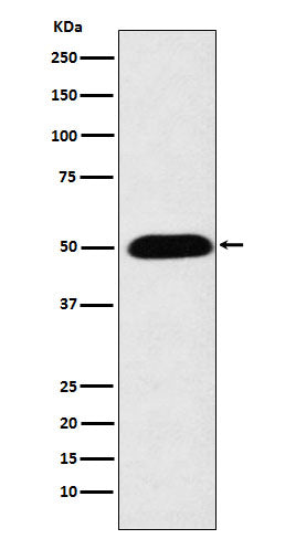 CYP27A1 (5H15) Rabbit Monoclonal Antibody