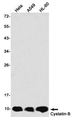 Cystatin B (7U18) Rabbit Monoclonal Antibody